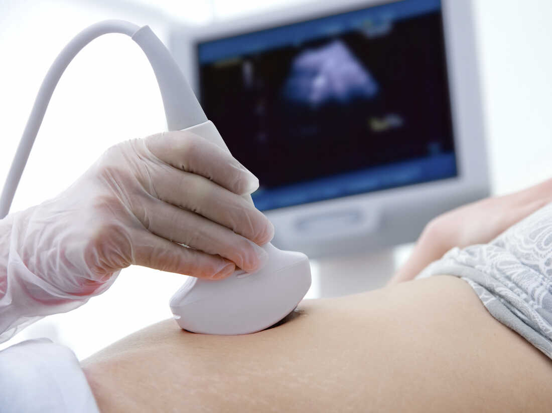 A woman gets a sonogram